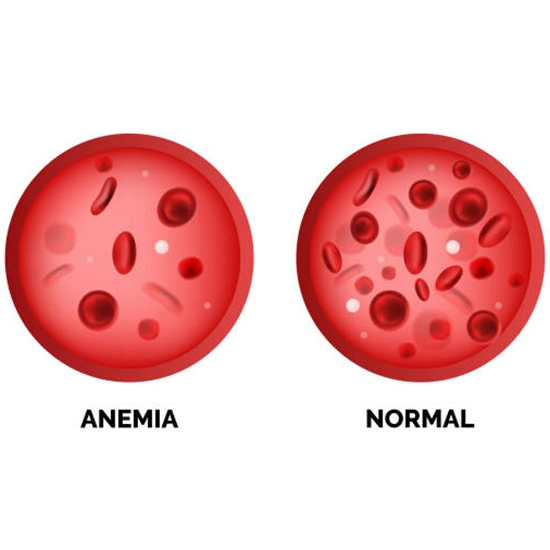 GDIC Anemia Profile-2 Package class=
